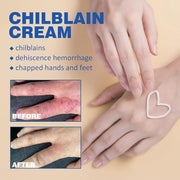 sjfscqr Anti-Cracking Frostbite Moisturiser Deep Nourishing,Cracks & Frostbite,Cracked Skin Repair Cream,for Dry Cracked Heels Callus Remover