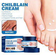 sjfscqr Anti-Cracking Frostbite Moisturiser Deep Nourishing,Cracks & Frostbite,Cracked Skin Repair Cream,for Dry Cracked Heels Callus Remover