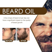 sjfscqr Beard Growth Organic Care Oil,Growth Oil Conditioner for Beard Care,Natural Beard Growth Essence,Moisturizes and Conditions Beard