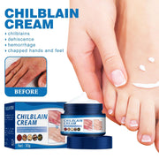 sjfscqr Anti-Cracking Frostbite Moisturiser Deep Nourishing,Cracks & Frostbite,Cracked Skin Repair Cream,for Dry Cracked Heels Callus Remover