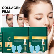 Soluble Freeze-Dried Collagen Film,Collagen Lifting Mask Kit,Freeze-Dried Forehead Mask Patch,for Skin Rejuvenation & Lifting