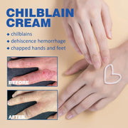 sjfscqr Anti-Cracking Frostbite Moisturiser Deep Nourishing,Cracks & Frostbite,Cracked Skin Repair Cream,for Dry Cracked Heels Callus Remover